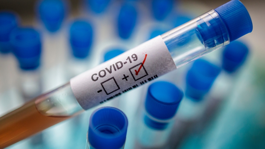 Reportan 17 nuevos casos de covid-19 que sigue a la baja en el país