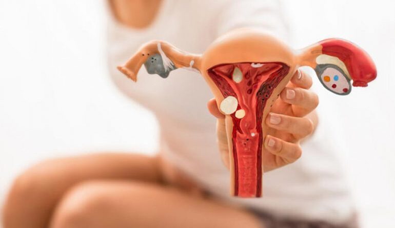 El 74% de mujeres tratadas con endometriosis en CEDIMAT presentan mejoría y 40% logra embarazo