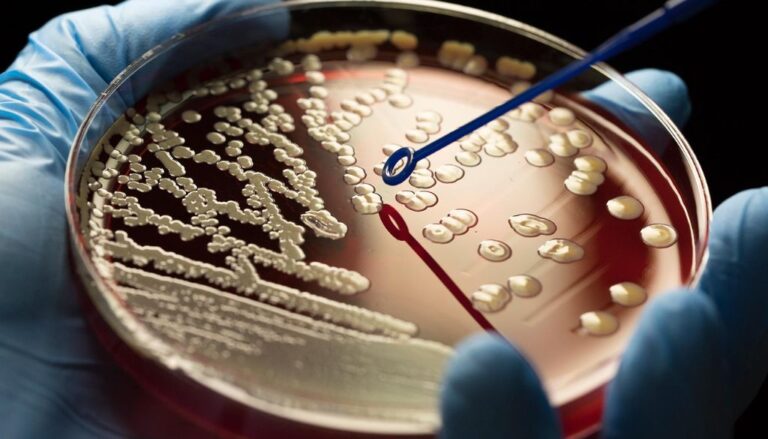 Shigella resistente a fármacos un reto global para la salud pública