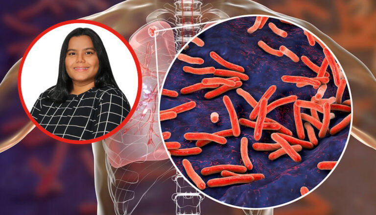Advierten estigmatización de tuberculosis afecta salud mental