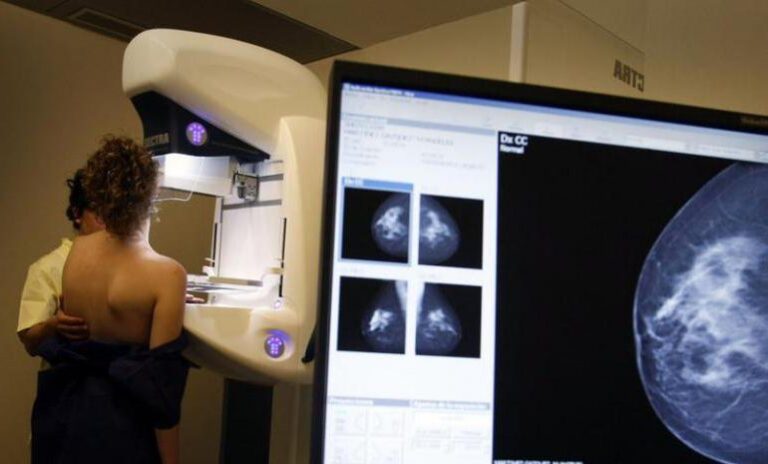 Pacientes con cáncer de mama metastásico pueden mejorar su expectativa de vida con medicamentos innovadores
