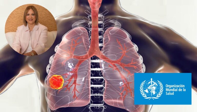 Tuberculosis farmacorresistente: un problema de salud pública en aumento