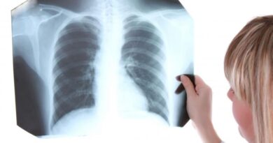Neumólogos conmemorarán Día de la Tuberculosis 