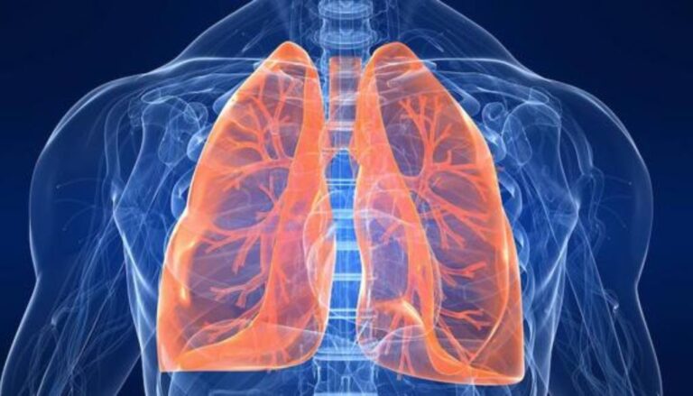 Sarcoidosis una enfermedad de origen desconocido y sin cura