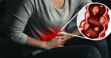 Advierten mujeres son las más diagnosticadas con cáncer de colon