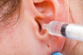 Pasos y cuidados para limpiar la cera de oídos con agua oxigenada