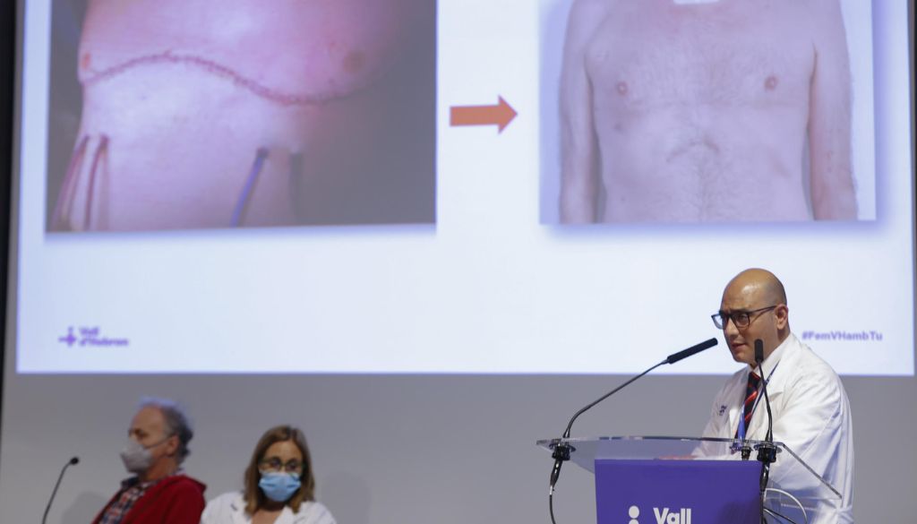 Hospital de Barcelona práctica el primer trasplante robótico