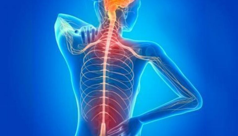 Esclerosis múltiple: La enfermedad de las mil caras