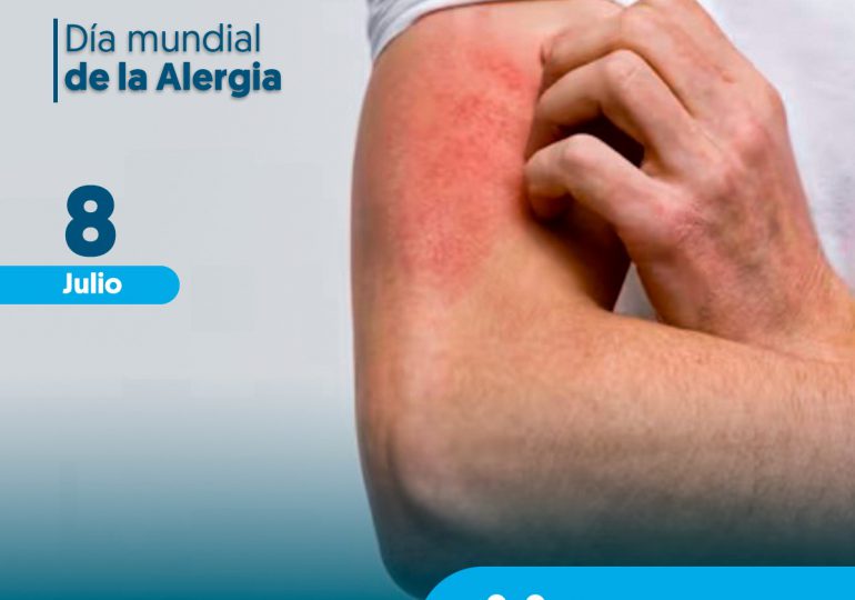Alergólogo Moscoso Puello identifica síntomas rinitis; llama a no confundirla con infecciones respiratorias