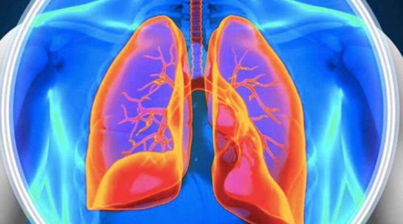 Expertos en hipertensión pulmonar piden ampliar los parámetros de diagnóstico