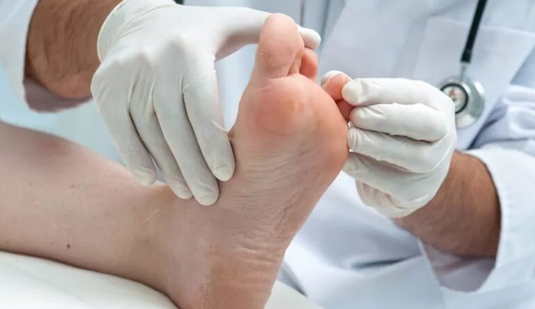 Especialista en pie diabético revela que en RD se producen hasta 7,000 amputaciones anuales
