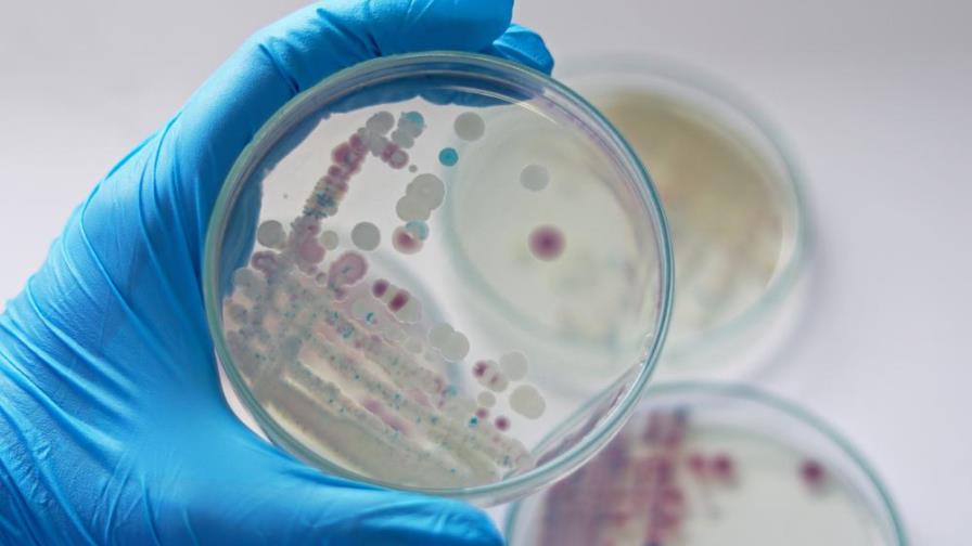 Florida reporta cinco muertes y 26 infectados en lo que va de año por la bacteria "come-carne"