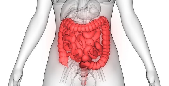 Tres causas de la sangre en las heces que no son cáncer de colon
