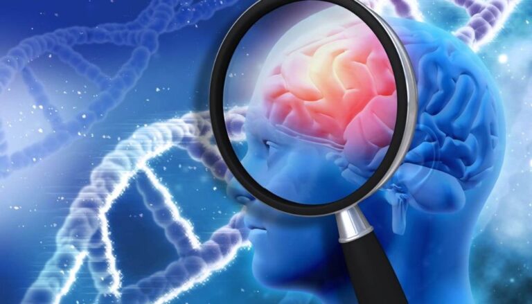 Metástasis cerebral: una investigación abre camino a la detección precoz