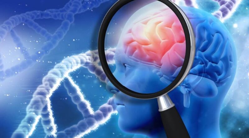 Metástasis cerebral: una investigación abre camino a la detección precoz
