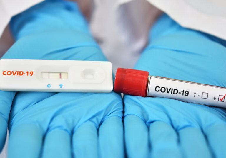 Casos de covid aumentaron un 80% en todo el mundo, aunque la mortalidad bajó