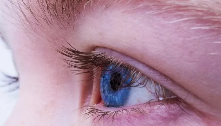 Pacientes con glaucoma luchan para que su enfermedad se considere neurodegenerativa