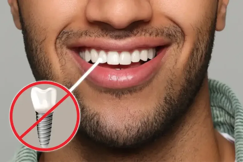 Implantes dentales sin tornillo: todo lo que necesitas saber