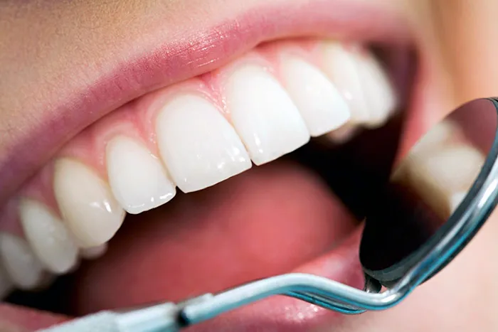 Invitan a webinar “De la ortodoncia tradicional al anclaje esqueletal”
