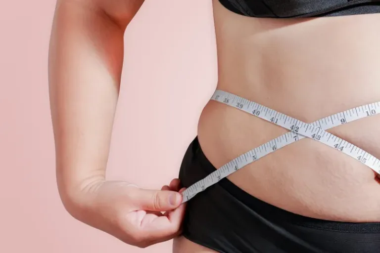 Una de cada 8 personas en el mundo sufre obesidad, ya la forma más común de malnutrición