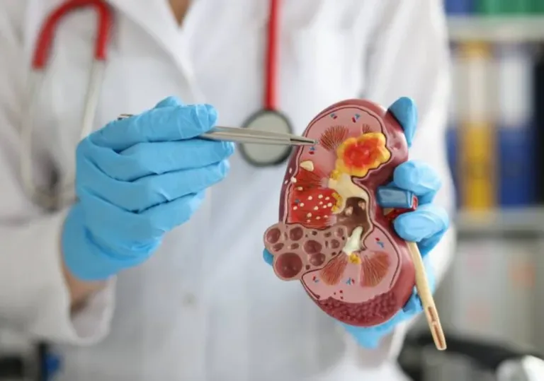 Doctora Eliana Diná destaca la importancia del diagnóstico temprano en enfermedad renal
