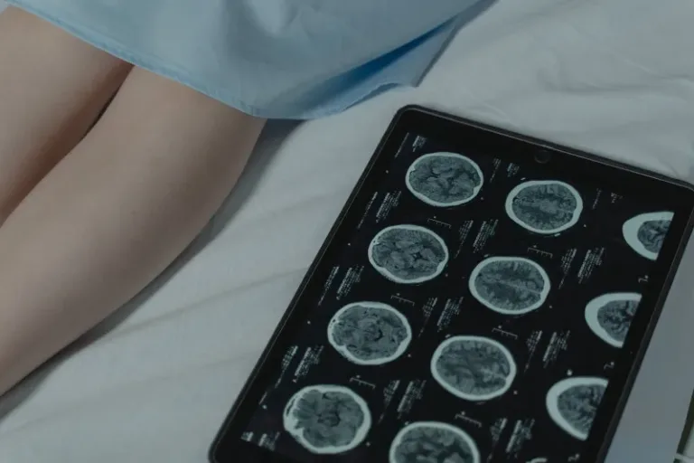 La genética, y no la falta de oxígeno, causa la parálisis cerebral en una cuarta parte de los casos