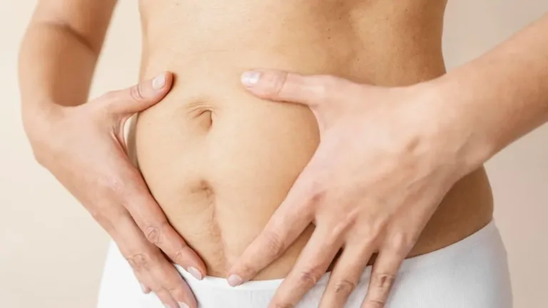 Mujeres experimentan diástasis de recto abdominal tras el parto
