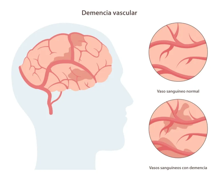 dementia.webp.webp