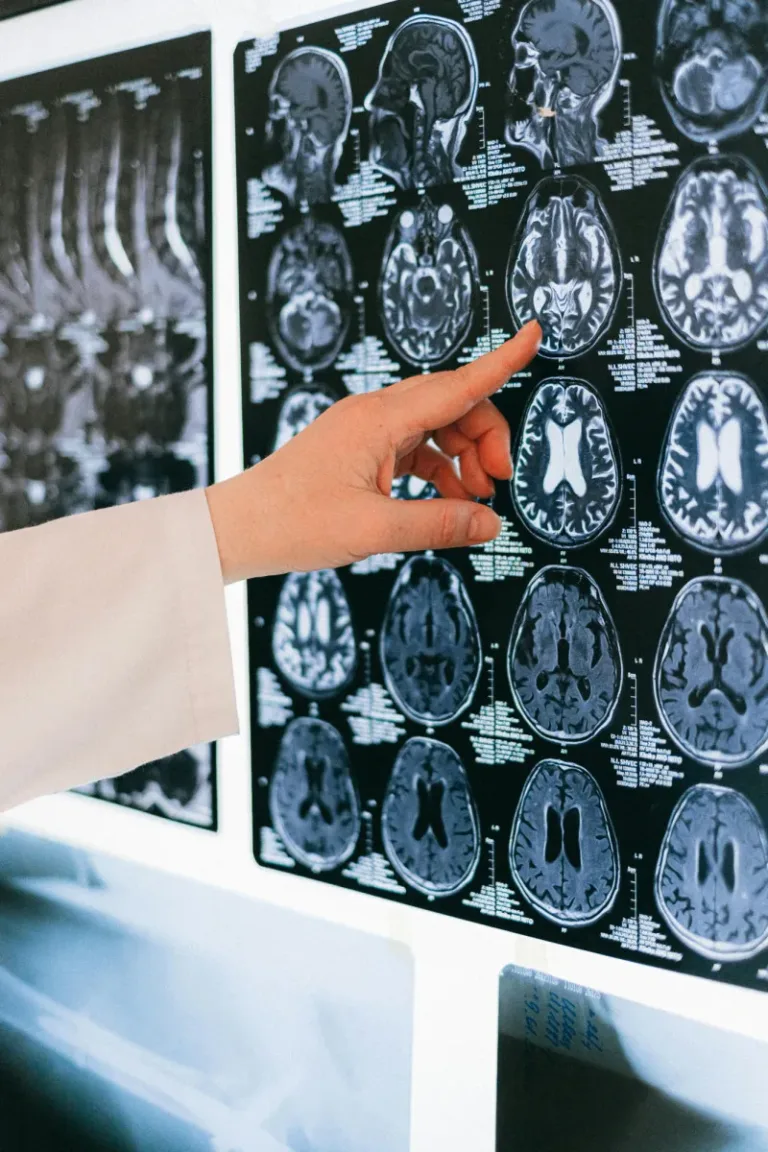 Estudio revela que la desigualdad social está vinculada a una menor salud cerebral