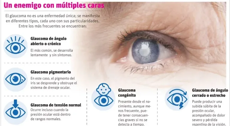 OJOS