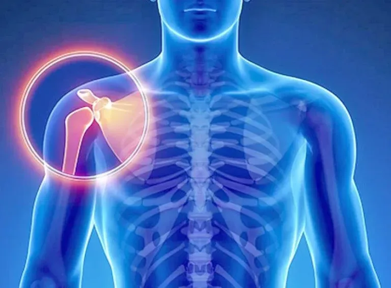 Sarcoma: el cáncer silencioso que amenaza a jóvenes