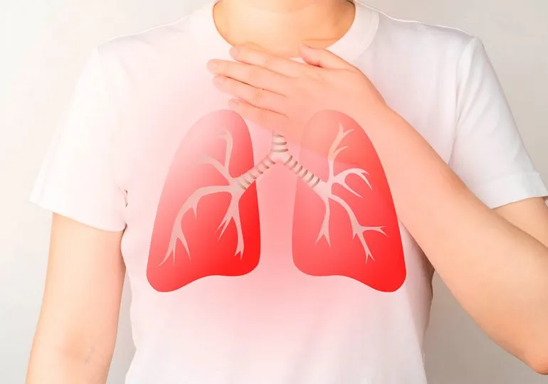 Seis de cada diez dominicanos podrían tener tuberculosis latente, según expertos
