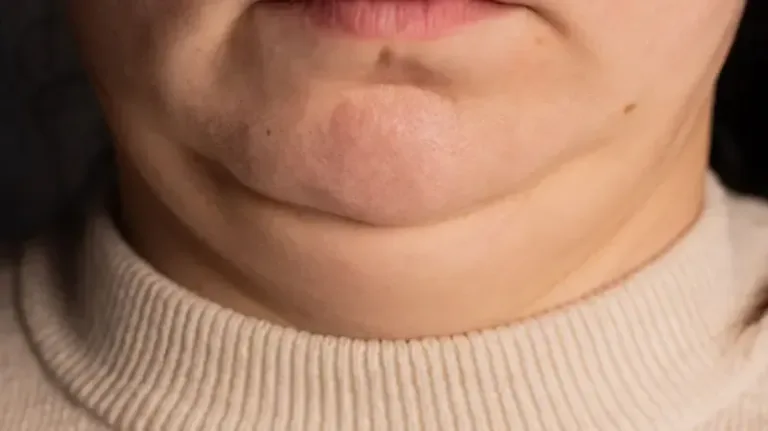 ¿Qué dice el tamaño de tu cuello sobre tu salud?
