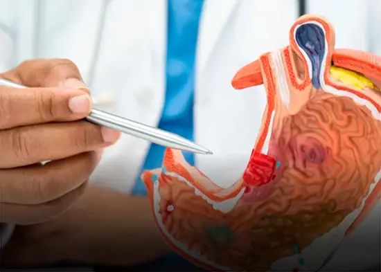 Prevenir el cáncer de páncreas es posible, afirma nutrióloga
