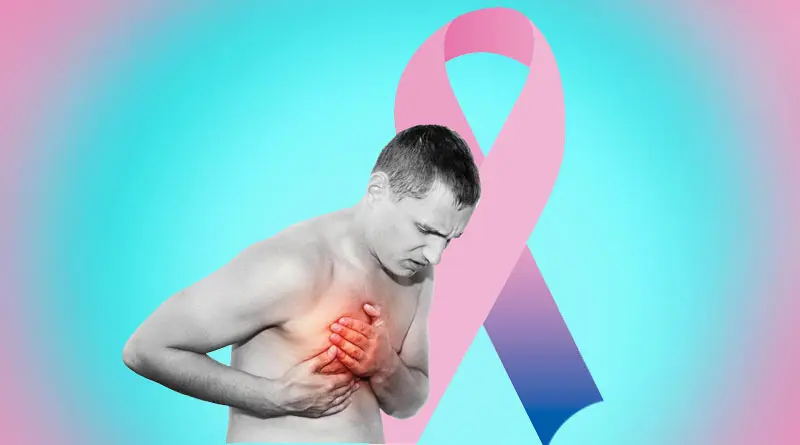 El cáncer de mama en los hombres.