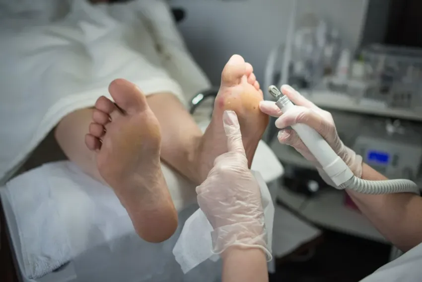 ¿Sabías que tus pies pueden revelar si tienes diabetes o mala circulación?