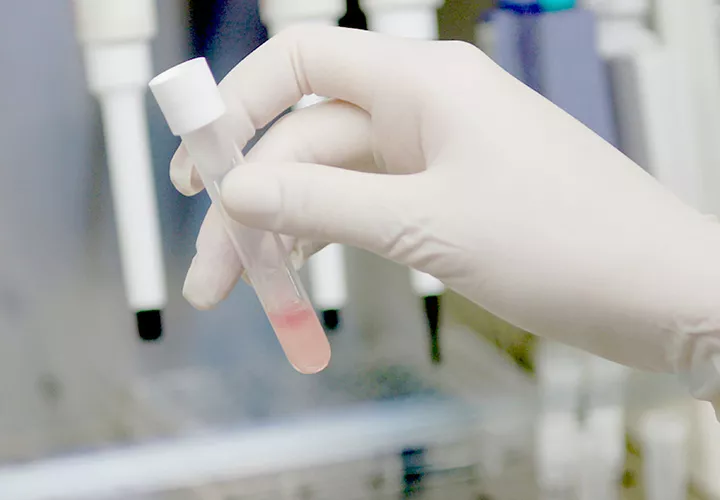 La saliva podría ayudar a predecir la evolución del cáncer de cabeza y cuello