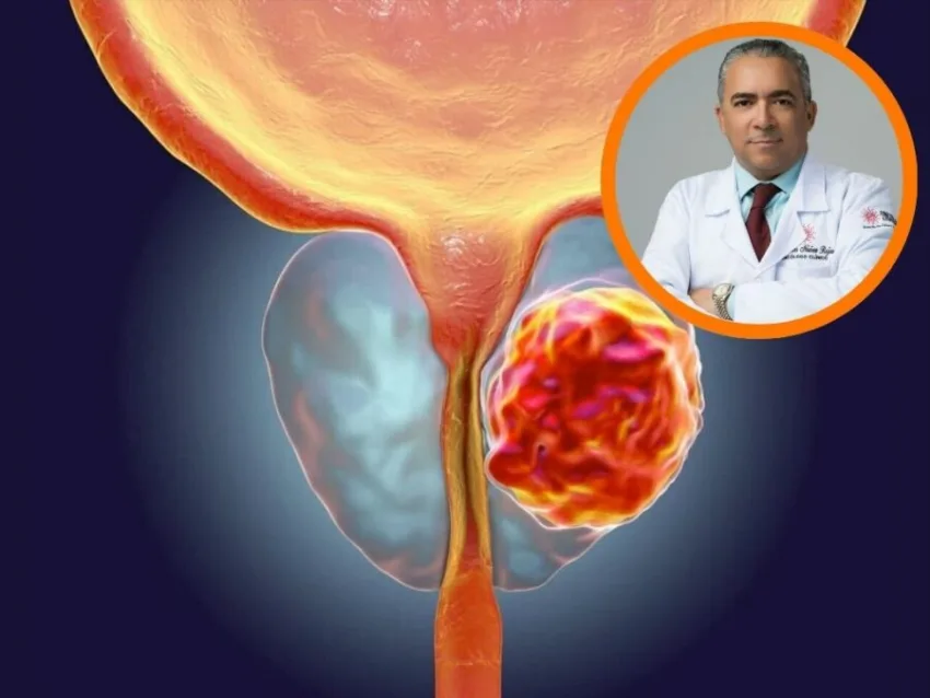 Oncólogo asegura detección temprana salva vida en cáncer próstata
