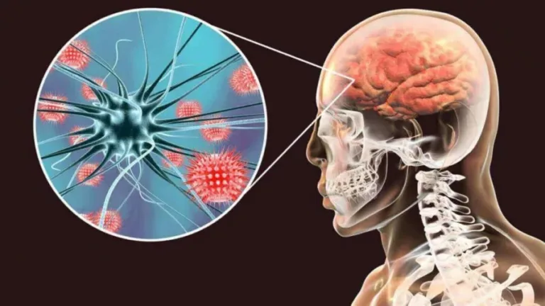 Ojo con la meningitis
