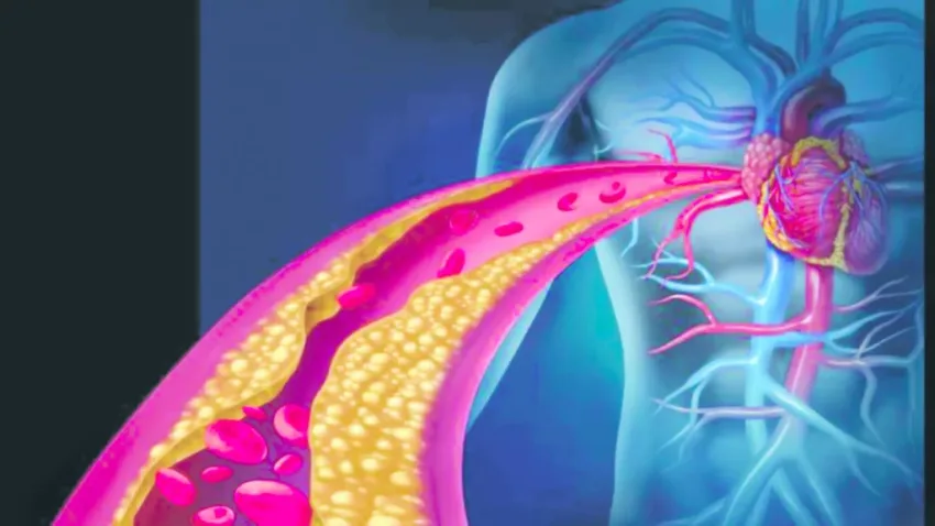 Científicos explican por qué los infartos son menos graves por la noche
