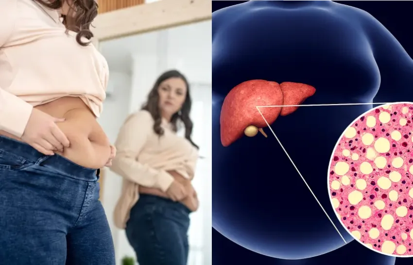 Este detox para el hígado graso me ayudó por fin a perder peso sin contar ni una sola caloría