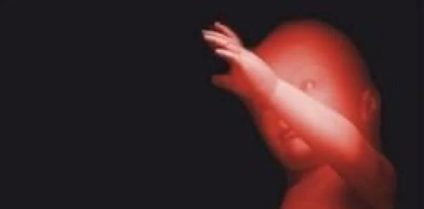 Sangre de cordón umbilical: alternativa segura frente a la sangre de adulto en prematuros extremos