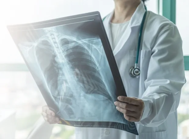 Lo que el neumólogo necesita saber para cuidar tus pulmones