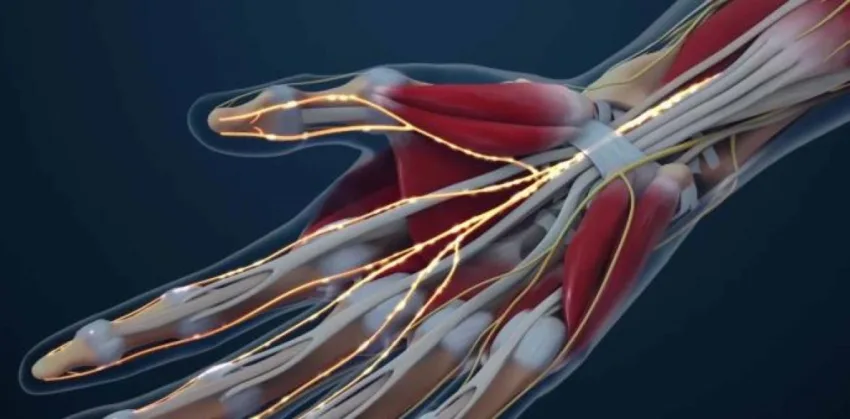 ¿La hidrodisección del nervio mediano es dolorosa?