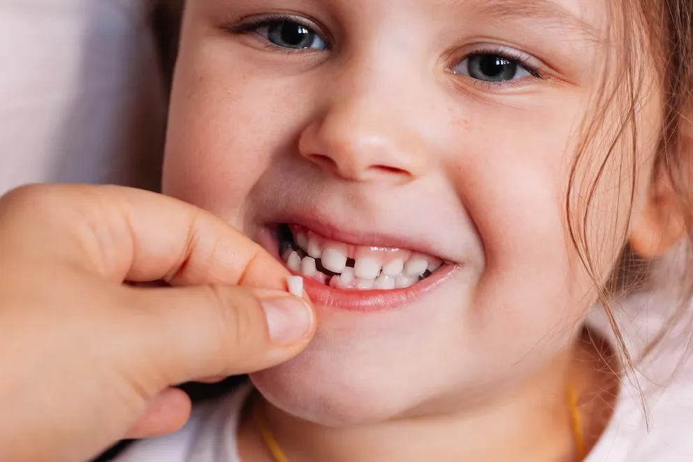 Cómo los dientes de leche podrían convertirse en una herramienta clave para predecir condiciones infantiles