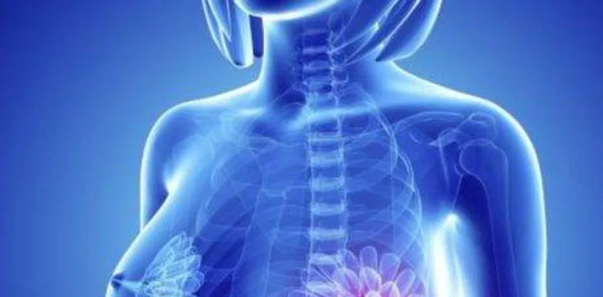 Menopausia: estudio revela cambios en las mamas que aumentan riesgo de cáncer