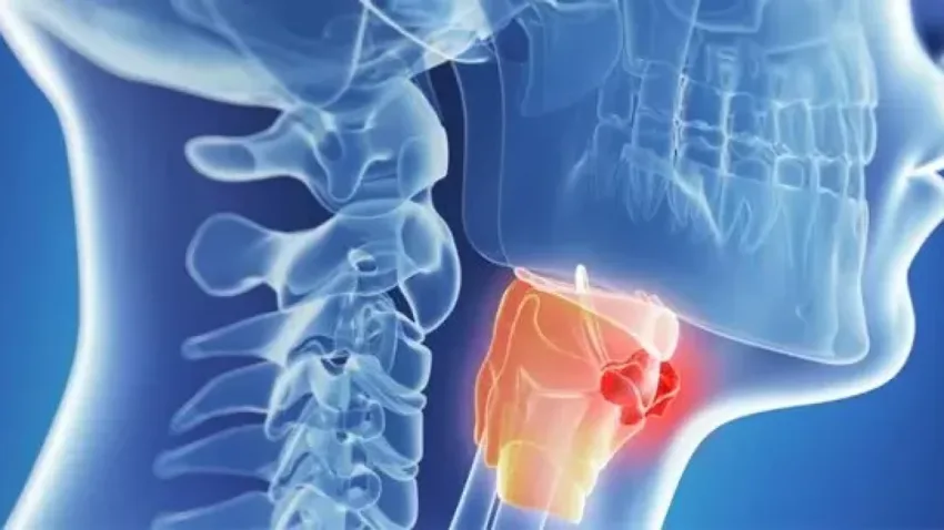 Abril, mes de Concienciación sobre Tumores Cabeza y Cuello