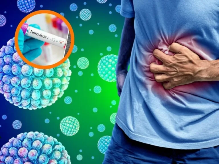 Norovirus: el virus que puede confundirse con una intoxicación alimentaria