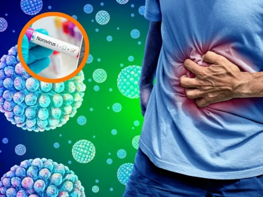 Norovirus: el virus que puede confundirse con una intoxicación alimentaria