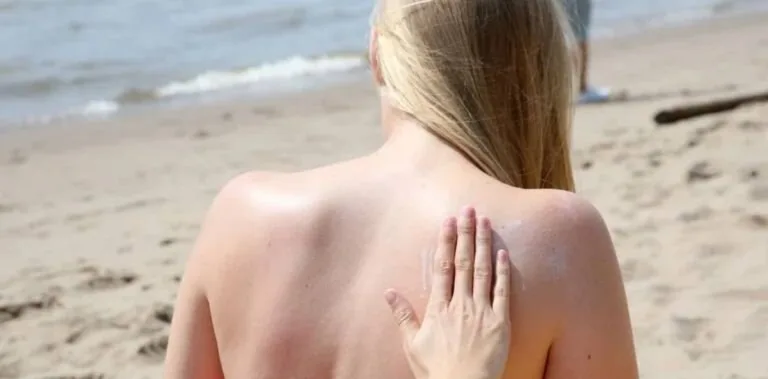 Cómo evitar manchas en la piel durante el verano